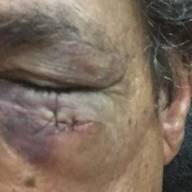 Em Birigui comissão julga improcedente denúncia de quebra de decoro de vereador por cabeçada