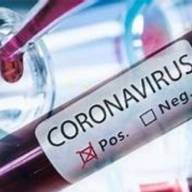Três Lagoas registra nesta terça-feira mais 27 casos confirmados de Covid